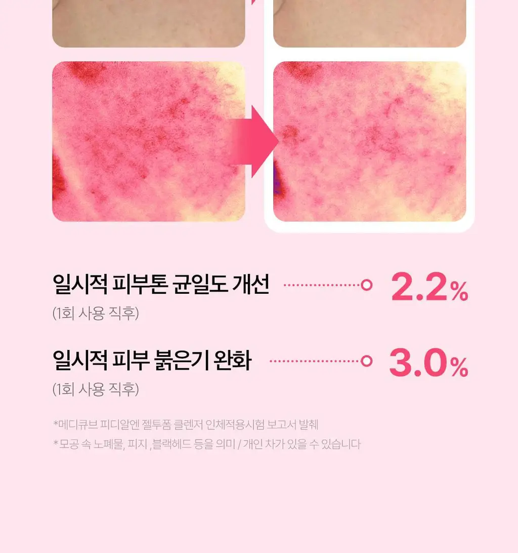 [저자극클렌저] 메디큐브 PDRN 젤투폼 클렌저 200ml 기획(+클렌징브러쉬 증정) 상세페이지 41
